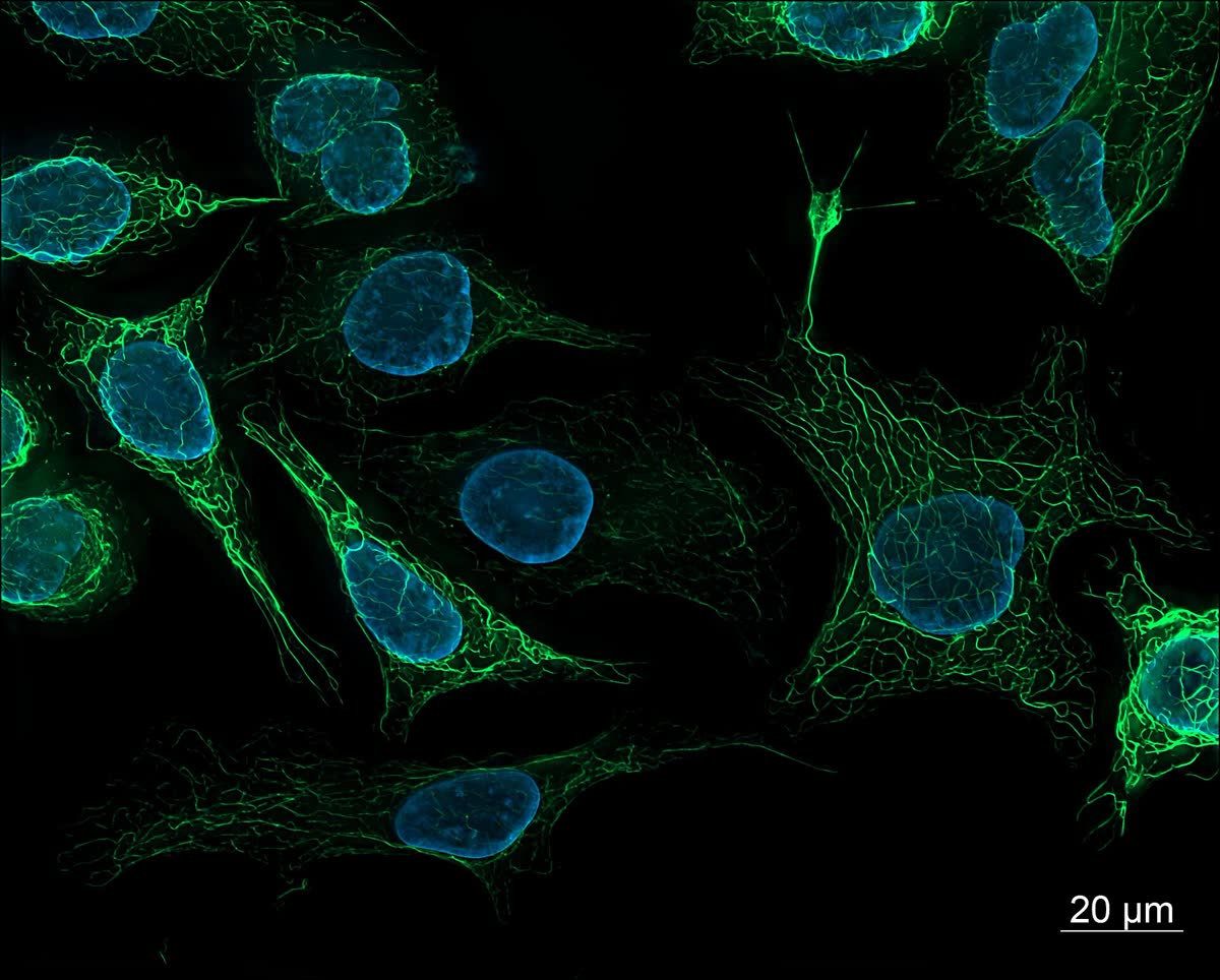 Human cells under a fluorescence microscope, nuclei in blue and structure in green