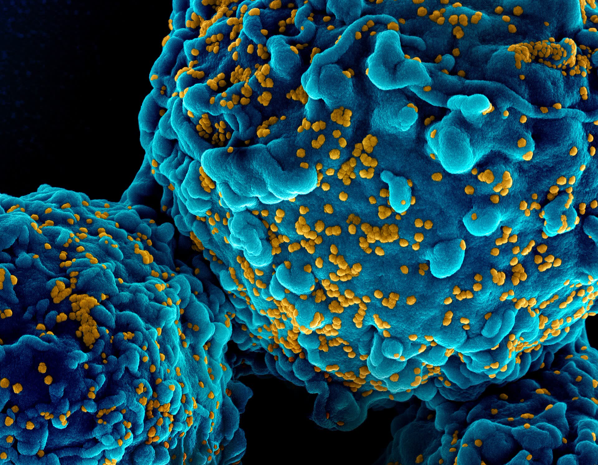 Coloured scanning electron micrograph of human immune cells covered in virus particles